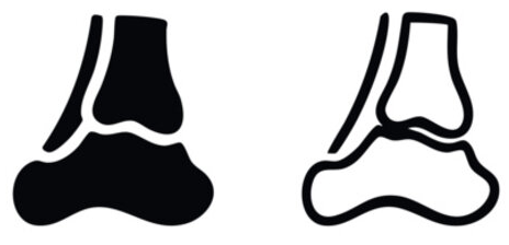 Bilateral Ankles