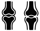 Bilateral Knees