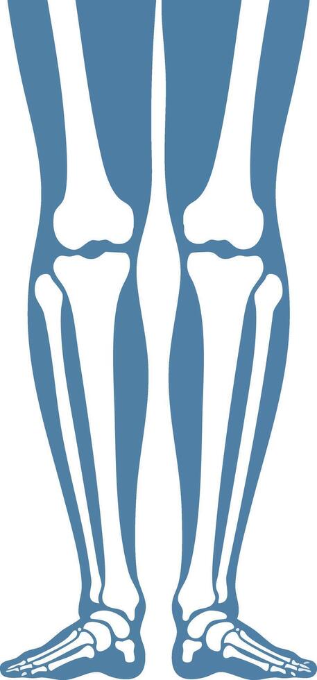 Lower Limbs